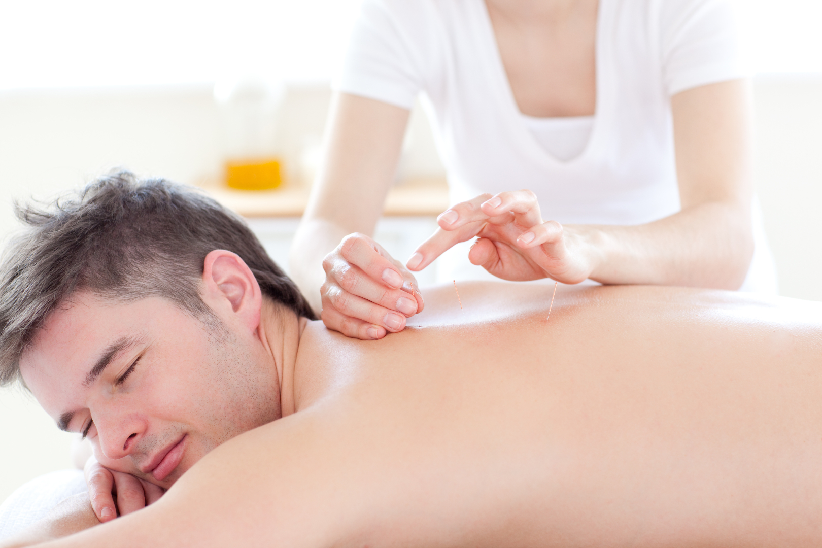 Smiling young man in an acupuncture therapy in a Spa center